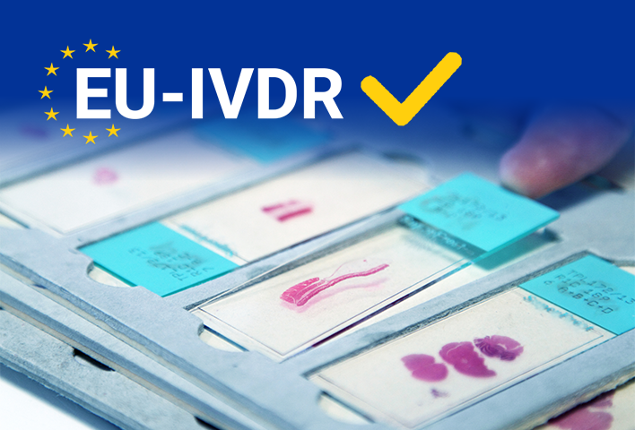 Nuovo regolamento (UE) 2017/746 sui prodotti diagnostici in vitro (IVDR)