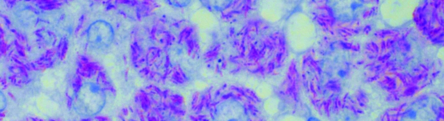 Dyes & Analytics