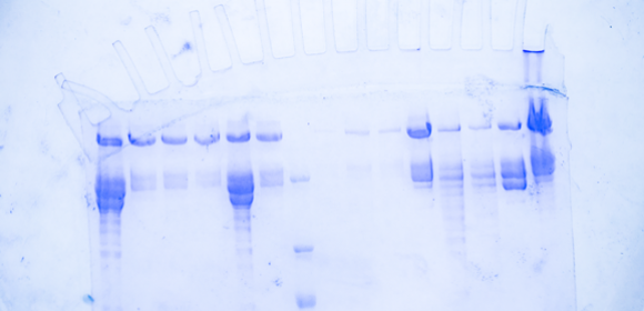 Proteinbiochemie und Elektrophorese