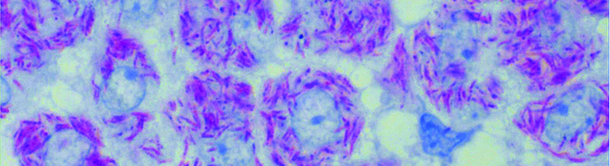 Colorants et Analyses