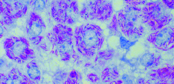 Colorants et Analyses